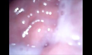 Livecam far brashness vagina with the addition of irritant